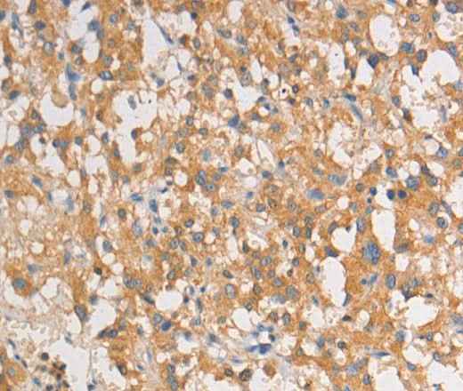 Anti-Human ART3 Antibody