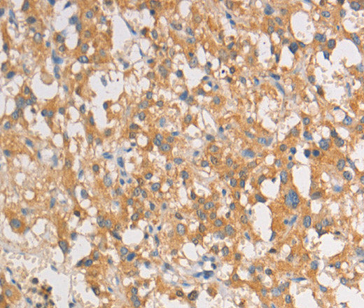 Anti-Human ART3 Antibody - ABMIUM