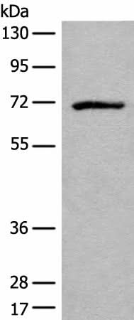 Western blot analysis of Jurkat cell lysate using ADGRE3 Polyclonal Antibody at dilution of 1:550