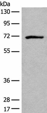Western blot analysis of Jurkat cell lysate using ADGRE3 Polyclonal Antibody at dilution of 1:550