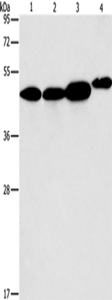 Anti-Human/Mouse ARFGAP1 Antibody - ABMIUM
