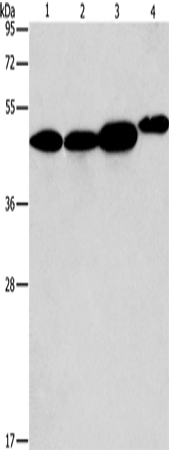 Anti-Human/Mouse ARFGAP1 Antibody - ABMIUM