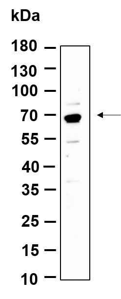 Anti-Human/Mouse/Rat p70 S6 Kinase Antibody [B1160] - ABMIUM