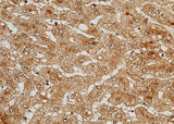 Anti-Human C5 Antibody [B116]