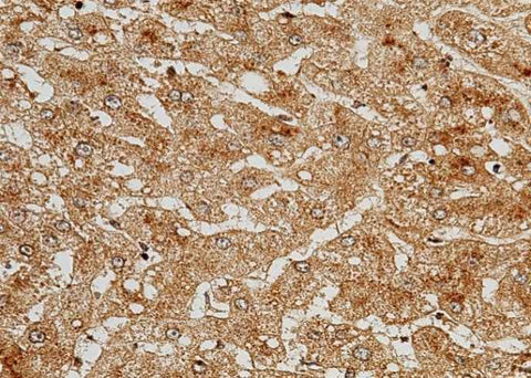 Anti-Human C5 Antibody [B116] - ABMIUM