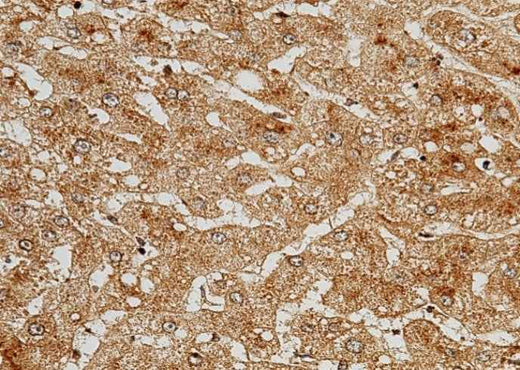 Anti-Human C5 Antibody [B116] - ABMIUM