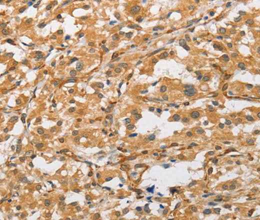 Anti-Human/Mouse/Rat ARMCX1 Antibody