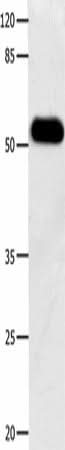 Western blot analysis of Human notum skin cancer tissue using DOK3 Polyclonal Antibody at dilution of 1:500