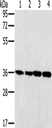 Anti-Human/Mouse MRPL39 Antibody - ABMIUM