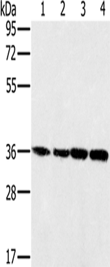 Anti-Human/Mouse MRPL39 Antibody - ABMIUM
