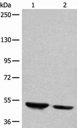 Anti-Human/Mouse DENND1B Antibody