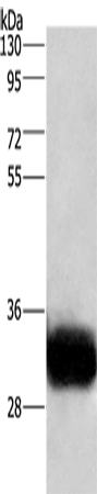 Anti-Human/Mouse/Rat GPM6A Antibody - ABMIUM
