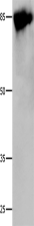 Anti-Human/Rat Caldesmon Antibody - ABMIUM