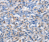 Anti-Human/Mouse/Rat PIM1 Antibody - ABMIUM