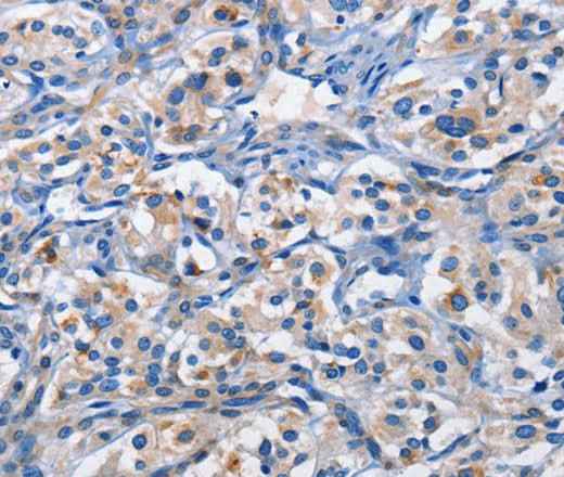 Anti-Human/Mouse/Rat PIM1 Antibody