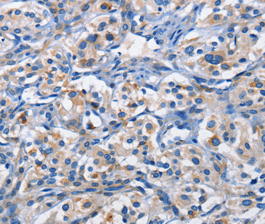 Anti-Human/Mouse/Rat PIM1 Antibody - ABMIUM