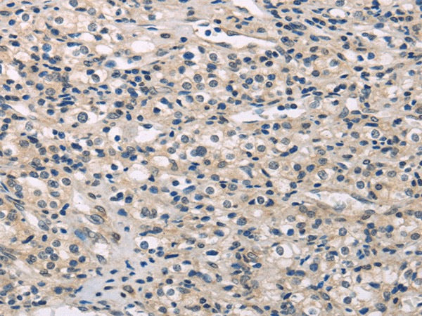 Anti-Human/Mouse/Rat MED28 Antibody - ABMIUM