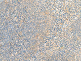 Immunohistochemistry of paraffin-embedded Human tonsil tissue using IFNA5 Polyclonal Antibody at dilution of 1:35(×200)