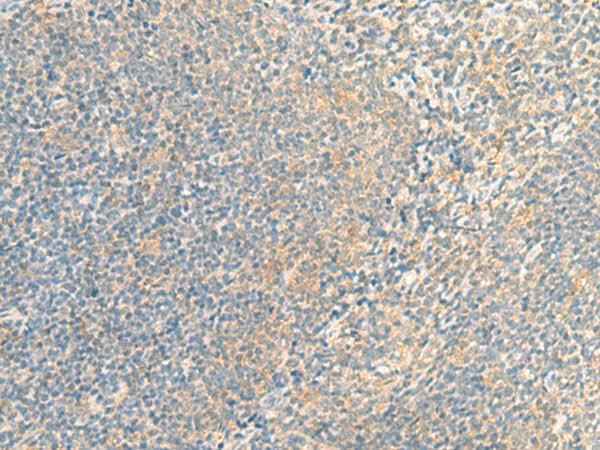 Anti-Human IFNA5 Antibody