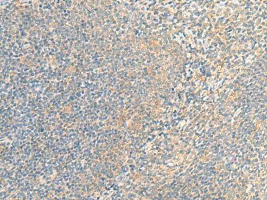 Anti-Human IFNA5 Antibody