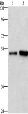 Anti-Human/Mouse/Rat SYT4 Antibody - ABMIUM