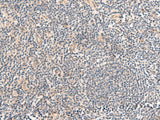 Immunohistochemistry of paraffin-embedded Human tonsil tissue using TEAD3 Polyclonal Antibody at dilution of 1:50(×200)