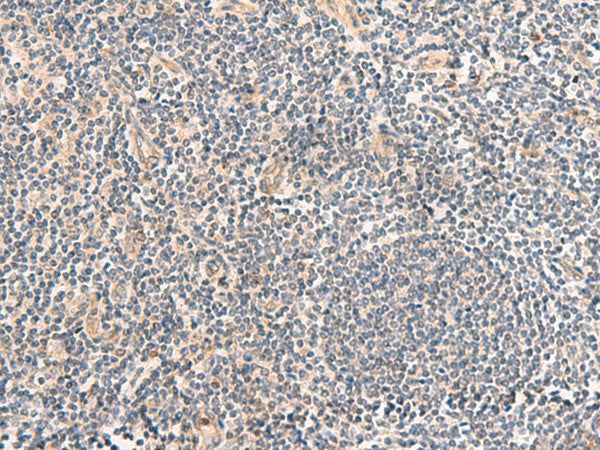 Immunohistochemistry of paraffin-embedded Human tonsil tissue using TEAD3 Polyclonal Antibody at dilution of 1:50(×200)