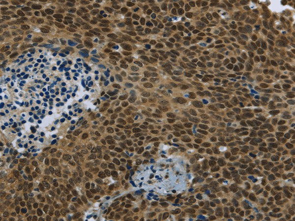 Anti-Human/Mouse/Rat SMAD4 Antibody - ABMIUM
