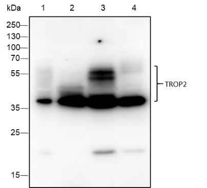 Anti-Human/Mouse TROP2 Antibody [A384]