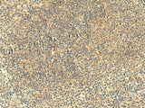 Immunohistochemistry of paraffin-embedded Human tonsil tissue using FMNL2 Polyclonal Antibody at dilution of 1:50(×200)