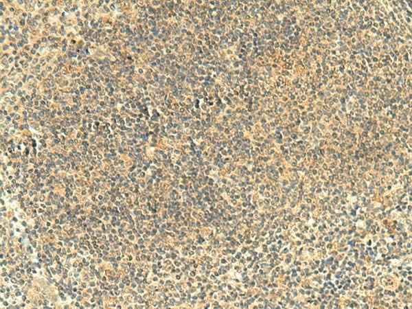 Anti-Human/Mouse FMNL2 Antibody