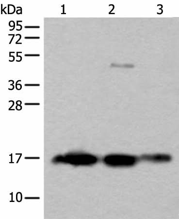Western blot analysis of Rat brain tissue Human cerebrum tissue Human cerebella tissue lysates using SNCB Polyclonal Antibody at dilution of 1:450
