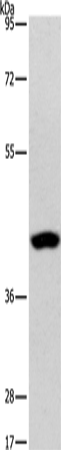 Anti-Human/Mouse AGXT2L2 Antibody - ABMIUM