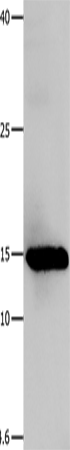 Anti-Human/Mouse/Rat LGALS1 Antibody - ABMIUM