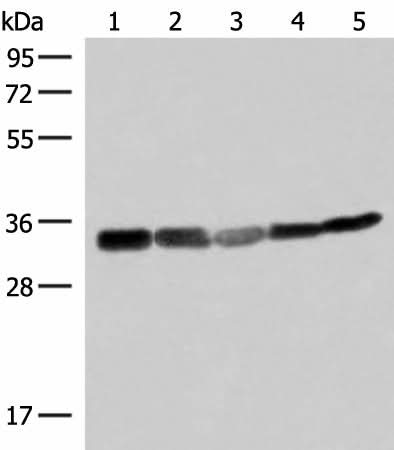 Western blot analysis of 293T HepG2 and A549 cell lysates using ECH1 Polyclonal Antibody at dilution of 1:200