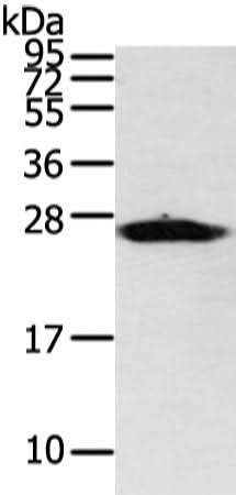 Anti-Human/Mouse/Rat VDAC3 Antibody - ABMIUM