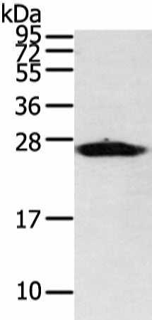 Anti-Human/Mouse/Rat VDAC3 Antibody - ABMIUM