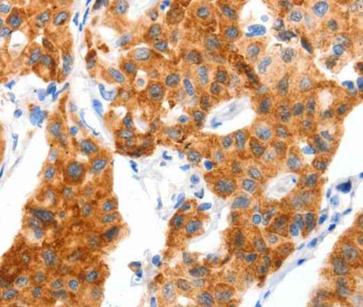 Anti-Human/Mouse/Rat SLC2A4 Antibody