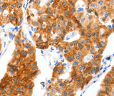 Anti-Human/Mouse/Rat SLC2A4 Antibody - ABMIUM
