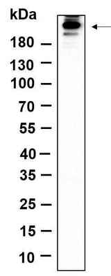 Anti-Human/Mouse/Rat Acetyl-CoA Carboxylase Antibody [B1158]