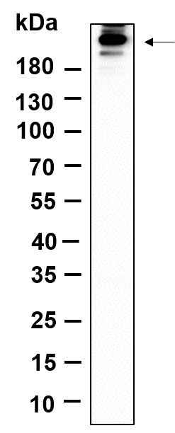 Anti-Human/Mouse/Rat Acetyl-CoA Carboxylase Antibody [B1158]