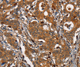 Anti-Human/Mouse CEACAM3 Antibody - ABMIUM