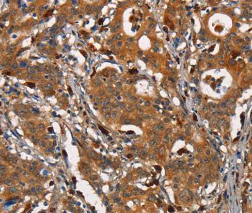 Anti-Human/Mouse CEACAM3 Antibody