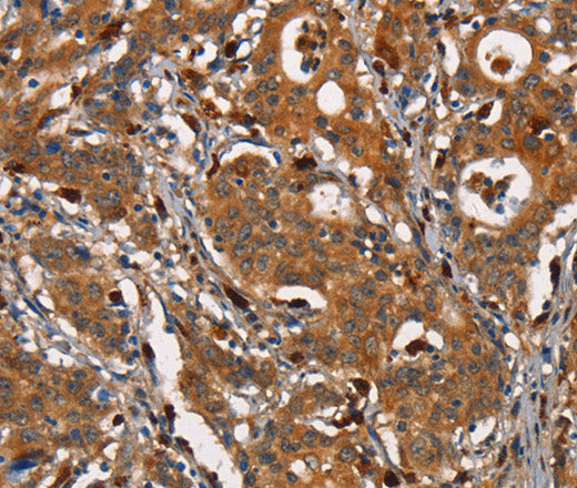 Anti-Human/Mouse CEACAM3 Antibody - ABMIUM