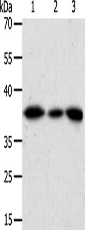 Anti-Human/Mouse/Rat AKR1A1 Antibody - ABMIUM