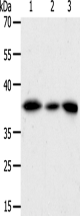 Anti-Human/Mouse/Rat AKR1A1 Antibody - ABMIUM