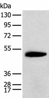 Western blot analysis of Mouse brain tissue using KCTD16 Polyclonal Antibody at dilution of 1:400