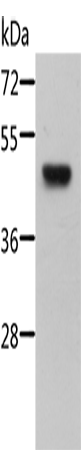 Anti-Human/Mouse STRADB Antibody - ABMIUM