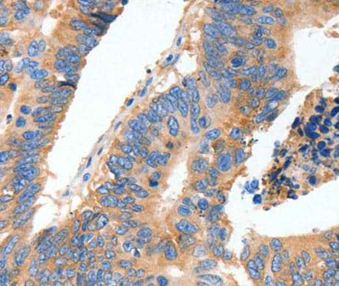Anti-Human MUC6 Antibody