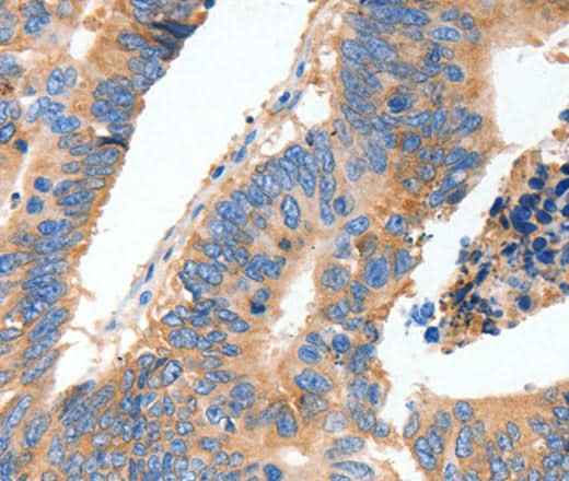 Anti-Human MUC6 Antibody